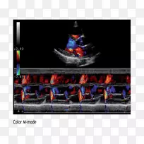 显示设备广告计算机监视器.先进技术-空若网 显示设备广告计算机监视器.先进技术-空若网