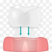 牙颌设计-空若网 牙颌设计-空若网
