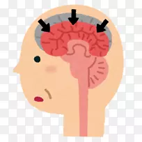 血管性痴呆合并路易体阿尔茨海默病脑血管病-阿尔茨海默病-空若网 血管性痴呆合并路易体阿尔茨海默病脑血管病-阿尔茨海默病-空若网