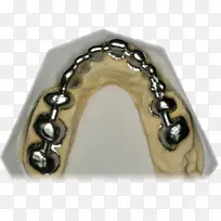 金属体首饰.牙科桥-空若网 金属体首饰.牙科桥-空若网