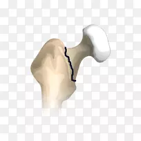 Ĵָ�μ����-������