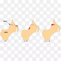 手指髋臼撞击Hüftgelenk股骨髋臼-空若网 手指髋臼撞击Hüftgelenk股骨髋臼-空若网