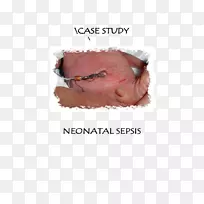 新生儿败血症-空若网 新生儿败血症-空若网