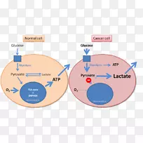 Warburg效应癌症Warburg假说糖酵解代谢技术敏感性效应-空若网 Warburg效应癌症Warburg假说糖酵解代谢技术敏感性效应-空若网