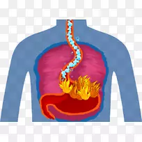 肾结石健康痛风食物尿酸-健康-空若网 肾结石健康痛风食物尿酸-健康-空若网