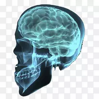 创伤性脑损伤-人脑肿瘤-空若网 创伤性脑损伤-人脑肿瘤-空若网