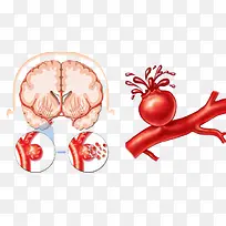 卡通心脑血管-空若网 卡通心脑血管-空若网