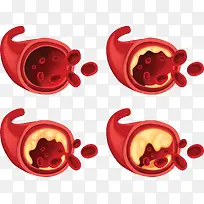 生物科学血管栓塞-空若网 生物科学血管栓塞-空若网