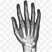 X光手腕骨-空若网 X光手腕骨-空若网