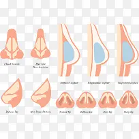 不同角度鼻子-空若网 不同角度鼻子-空若网