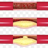 �Ķ���Ѫ�ܿ�ͨ�廭-������