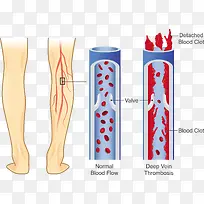 ʸ��Ѫ�ܶ�������-������