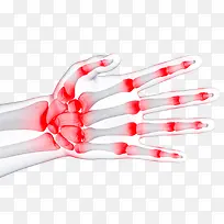 手指关节炎-空若网 手指关节炎-空若网