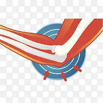 肘关节发炎插画-空若网 肘关节发炎插画-空若网