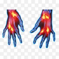 手指关节发炎-空若网 手指关节发炎-空若网