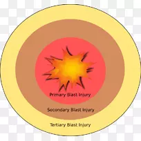 爆炸伤爆炸材料爆炸波解剖-空若网 爆炸伤爆炸材料爆炸波解剖-空若网